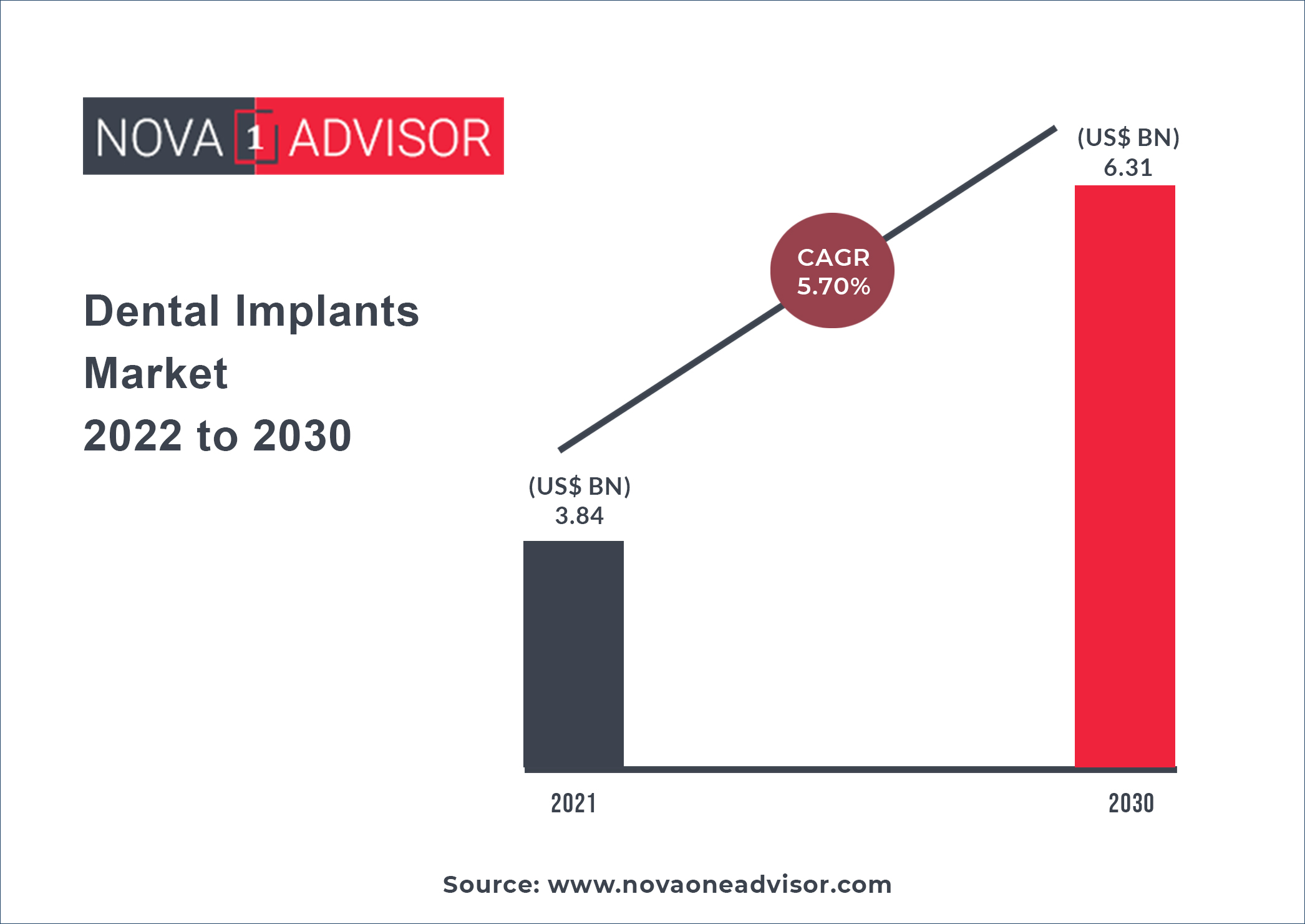 https://www.novaoneadvisor.com/reportimg/Dental-Implants-Market-2022-to-2030.jpg